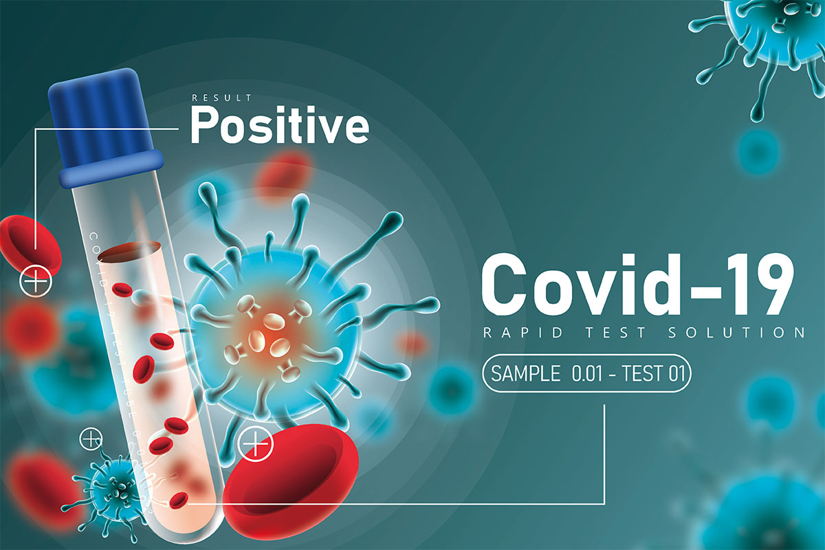  SARS-CoV-2 について （COVID-19） テスト